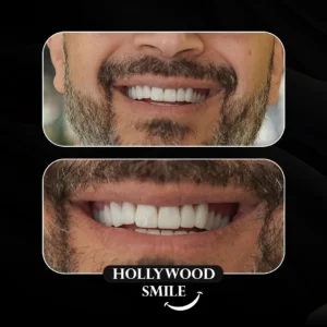 Dental Aesthetics in Turkey